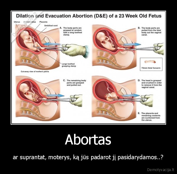 abortas, gyvenimas