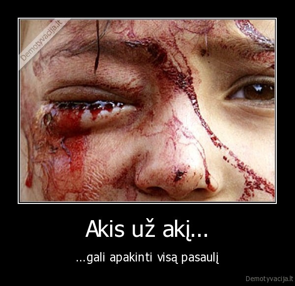 karas,vaikai,aukos,ghandi,akis,pasaulis,badas