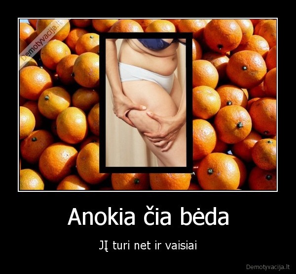 Anokia čia bėda