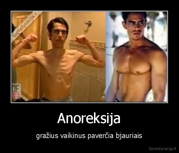 Anoreksija