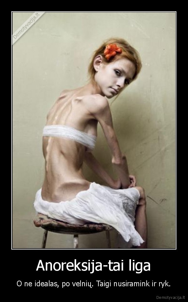 anoreksia