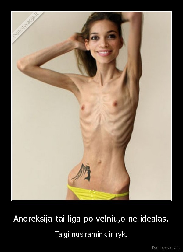 Anoreksija-tai liga po velnių,o ne idealas.