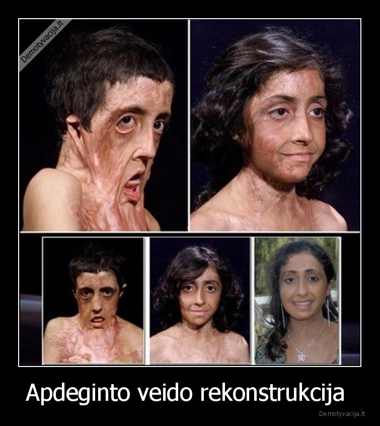 veidas,gaisras,wow,pries,po