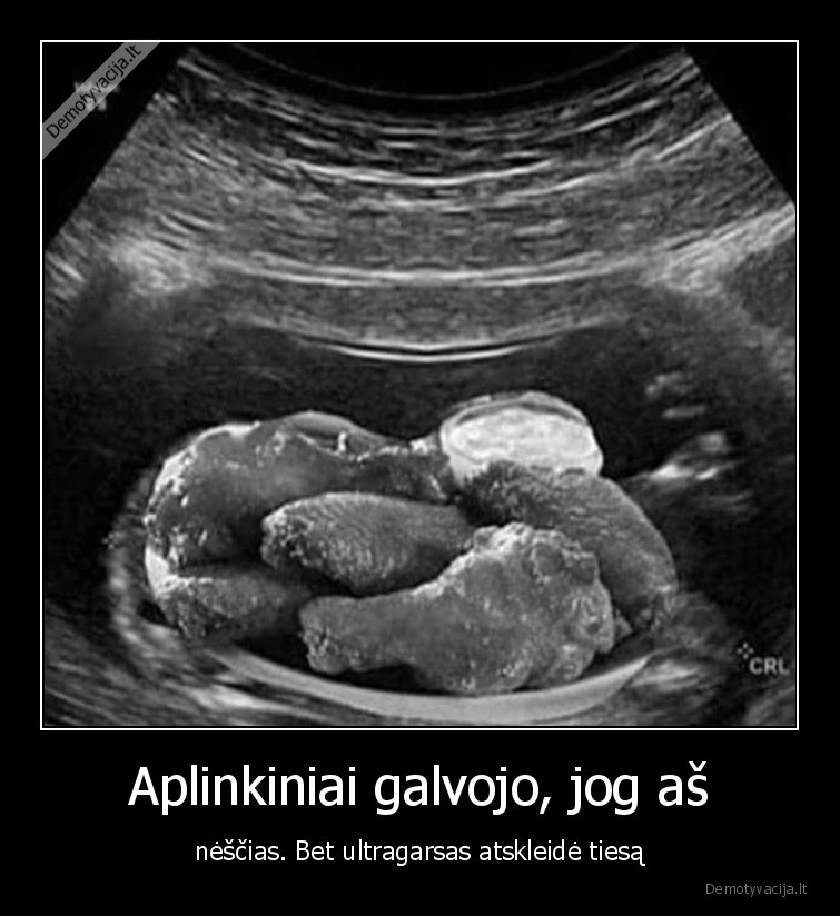 nescias,pilvas,ultragarsas,tiesa,maistas