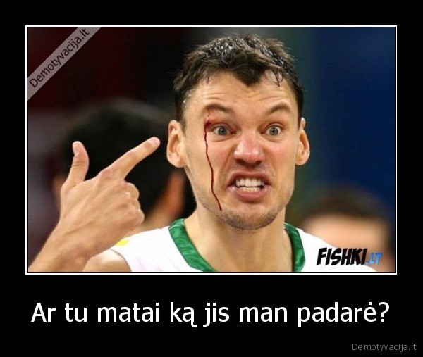 Ar tu matai ką jis man padarė?
