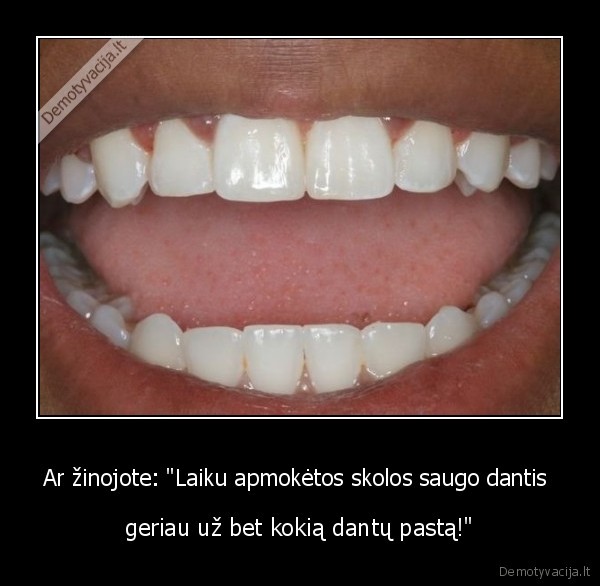Ar žinojote: &quot;Laiku apmokėtos skolos saugo dantis 