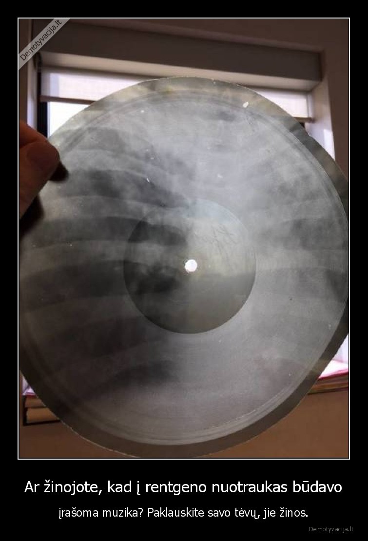 rentgenas,muzika,ssrs