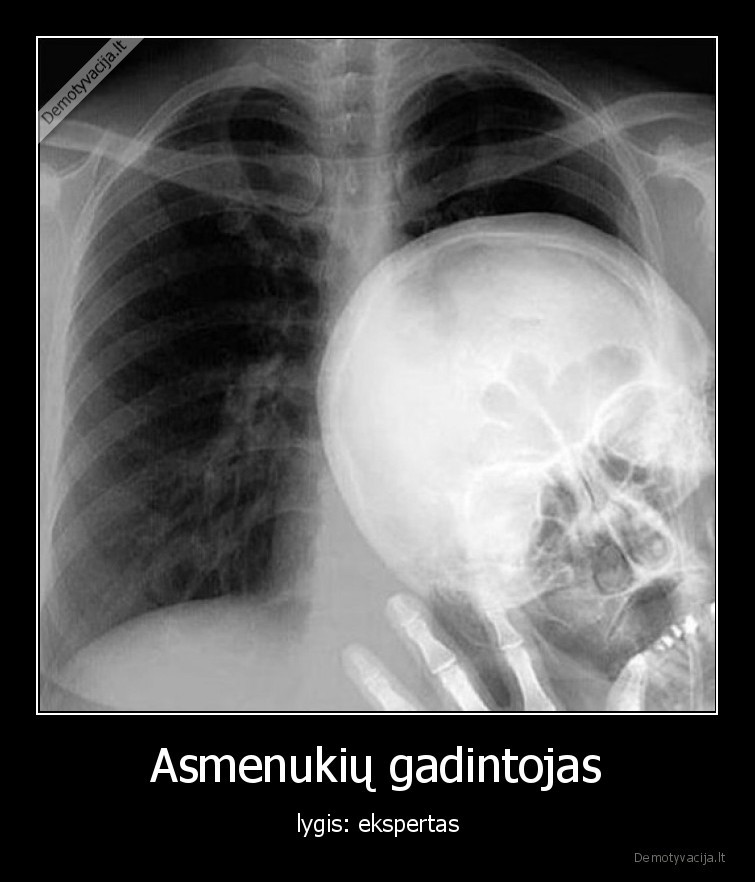 rentgenas,nuotraukos,gadintojas