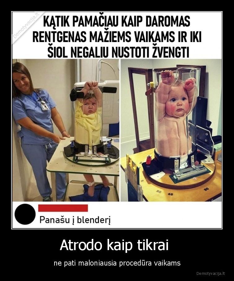 rentgenas,vaikai,lol