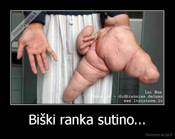 Biški ranka sutino...