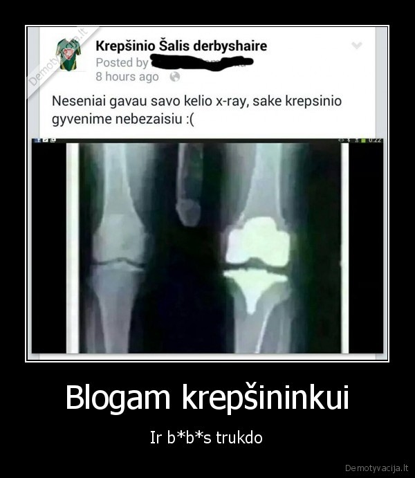 rentgenas,kaulu, nuotrauka,kelis