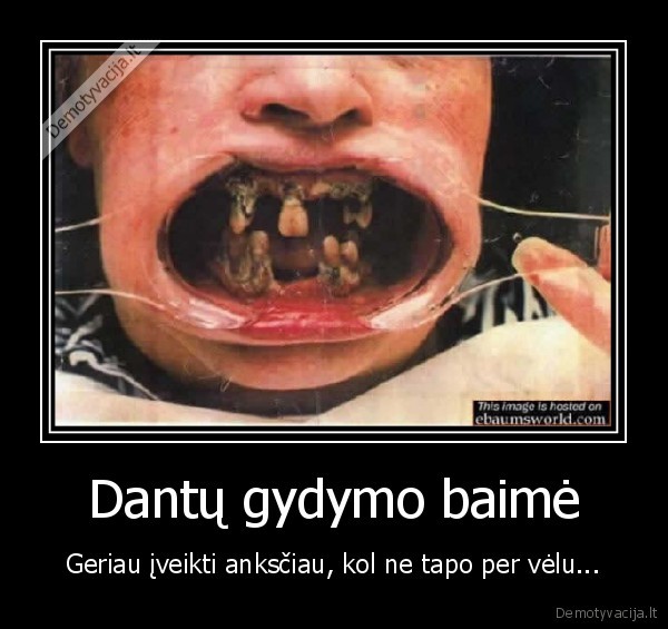 Dantų gydymo baimė
