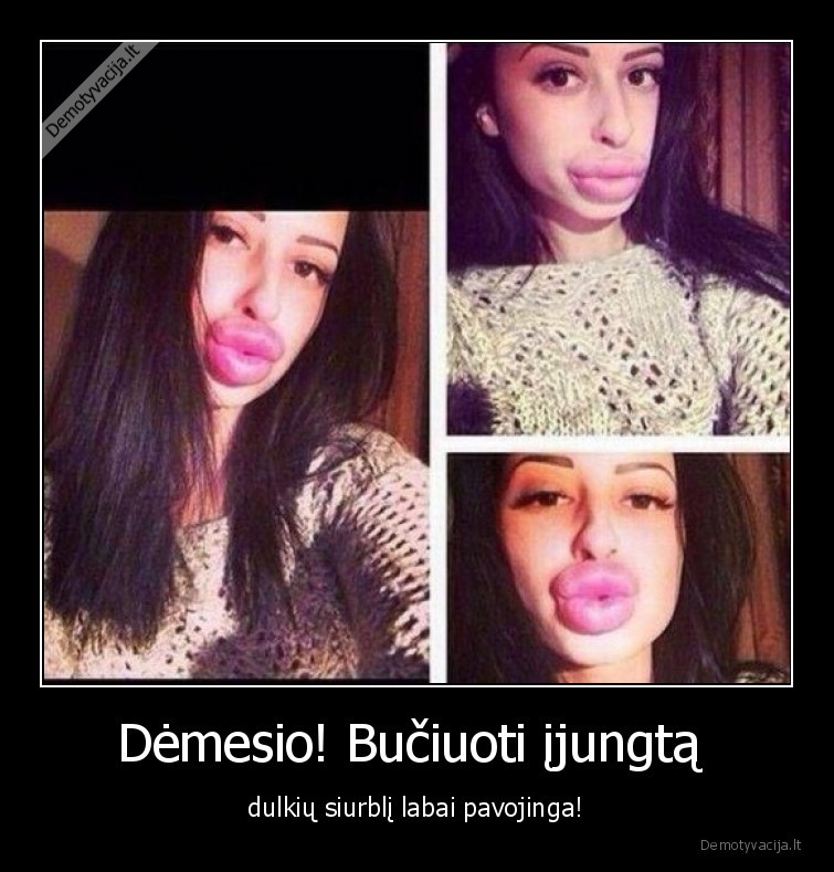 Dėmesio! Bučiuoti įjungtą 