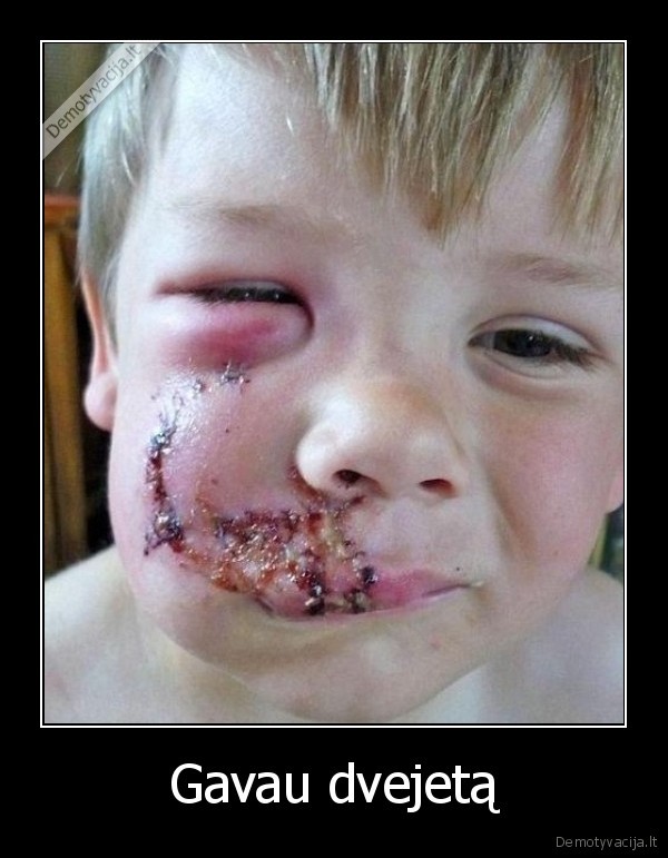 vaikas,mokykla,pazimys,veidas