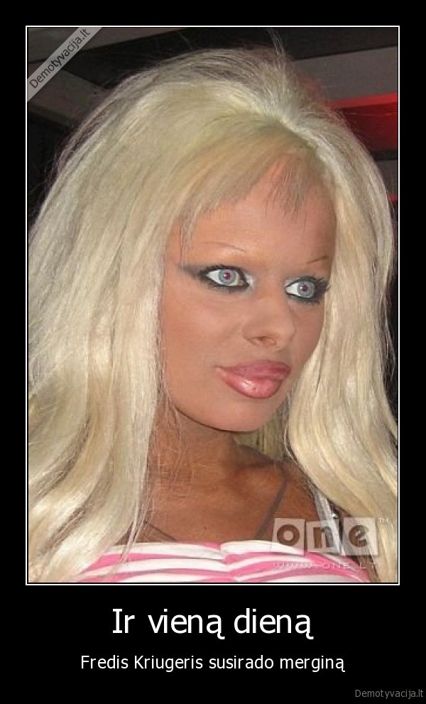 fredis, kriugeris,blondine,one.lt, nuotraukos,plastines, operacijos