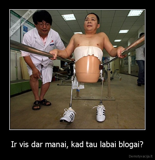 Ir vis dar manai, kad tau labai blogai?