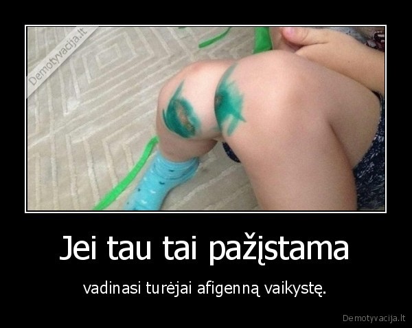 vaikyste,sudauzytas,kojos,begioti