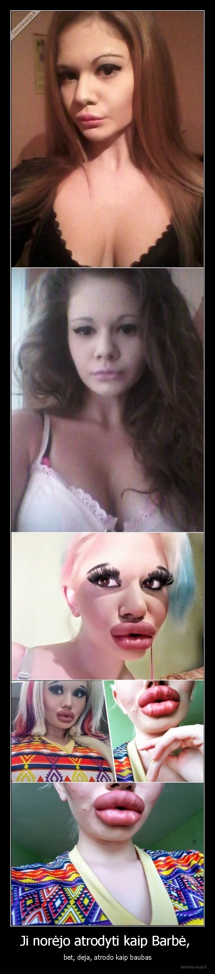 barbe,baubas,mergina,operacijos,lupytes