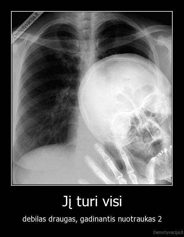 debilas,rentgenas,draugas