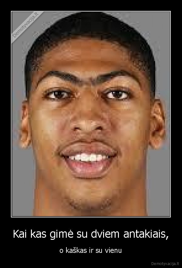 Kai kas gimė su dviem antakiais,