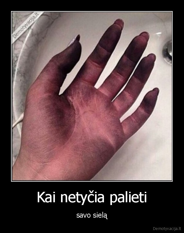 siela,rankos,sazine,purvas,liesti