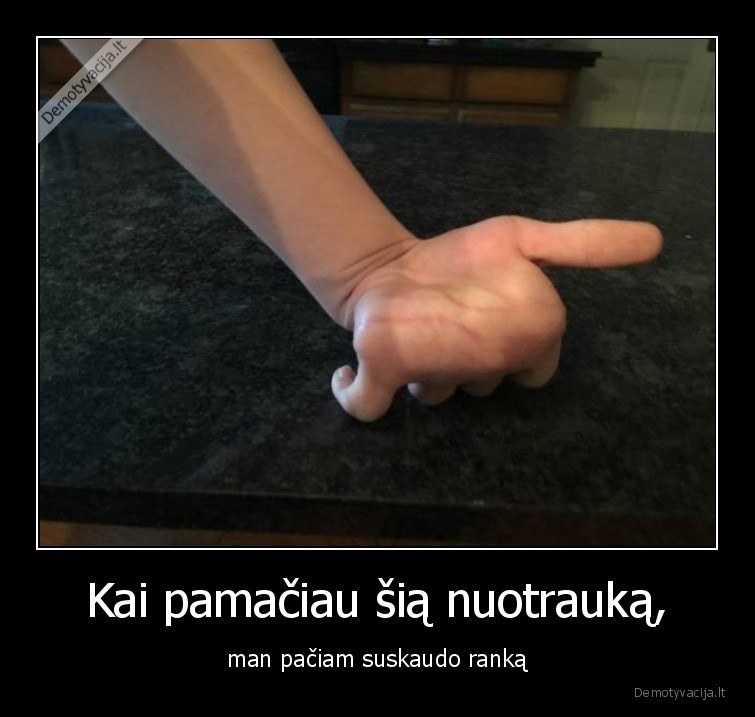 ranka,zmones,talentai,sugebejimai,rankos, lankstumas,suskaudo