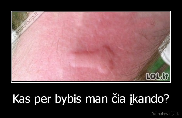 Kas per bybis man čia įkando?