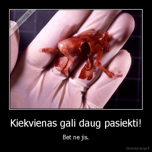 aborto, liekana,negimes, vaikas,nepavykes, gyvenimas