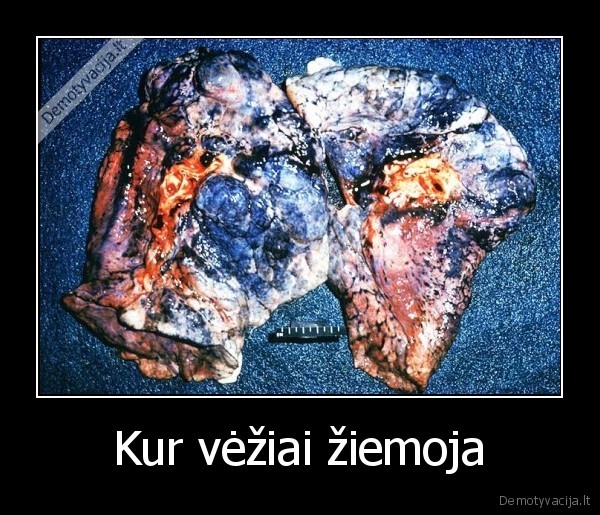 plauciai,cigaretes,rukymas