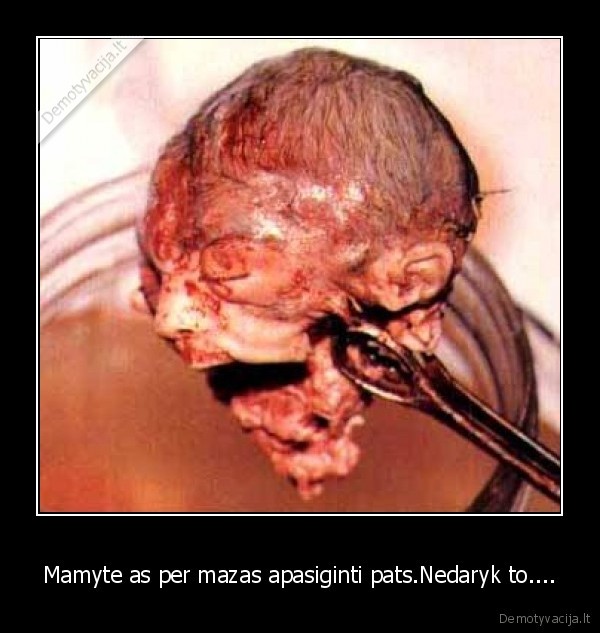 Mamyte as per mazas apasiginti pats.Nedaryk to....