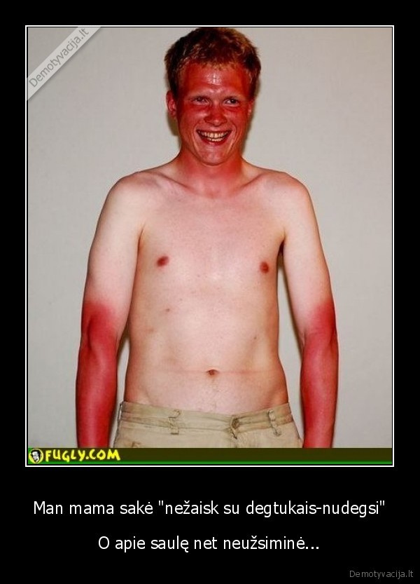 Man mama sakė "nežaisk su degtukais-nudegsi"