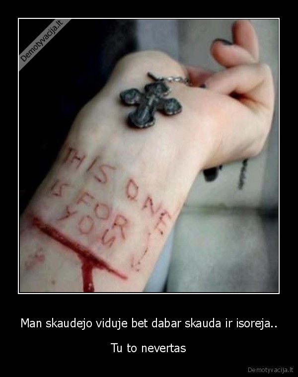 Man skaudejo viduje bet dabar skauda ir isoreja..