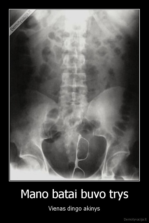 akiniai, isangeje,eilerastukas,akiniai, siknoj