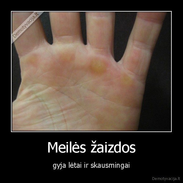 meile,zaizdos,nuospaudos