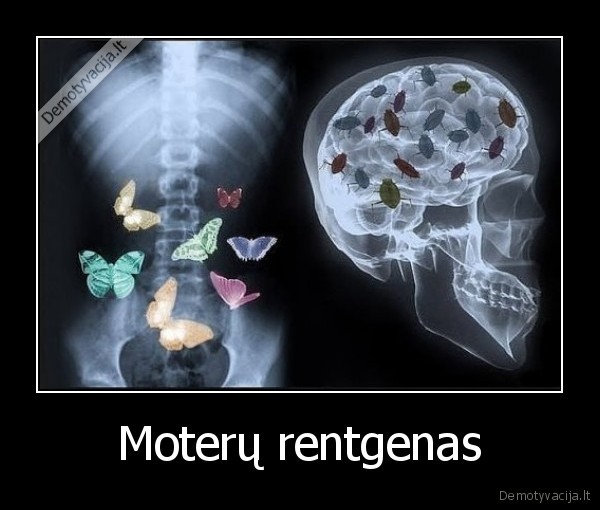 moterys,rentgenas