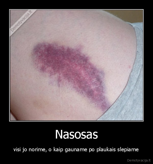 Nasosas