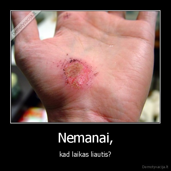 koks, idiotas, varo, su, kaire, ranka, iki, tiek, molis