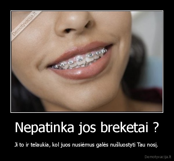 Nepatinka jos breketai ?