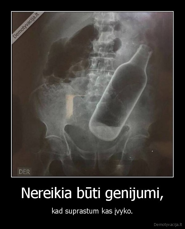 butelys,sikna,genijus,wtf