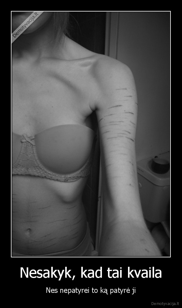 Nesakyk, kad tai kvaila