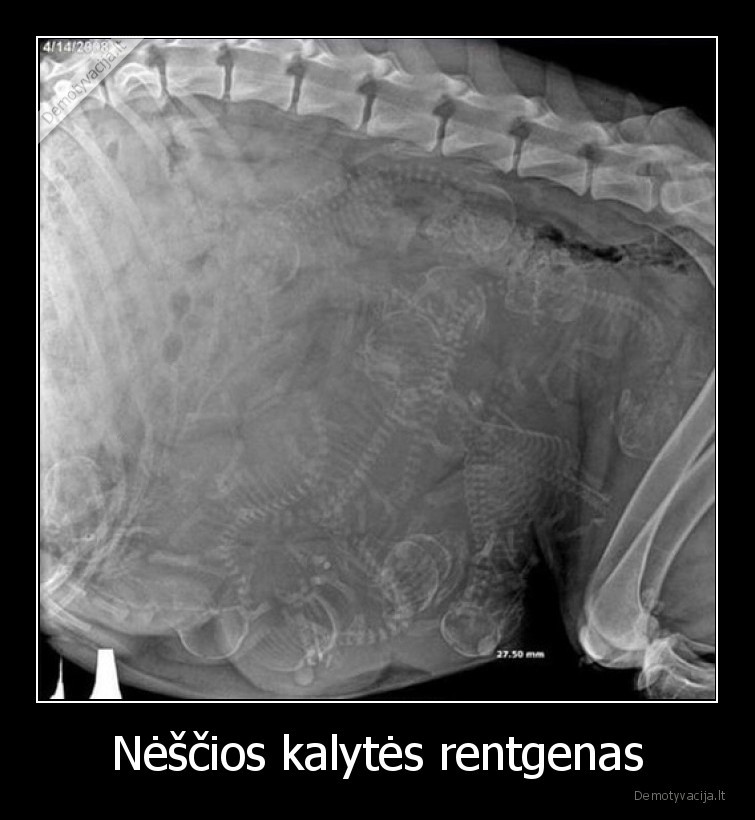 kalyte,vaikai,rentgenas