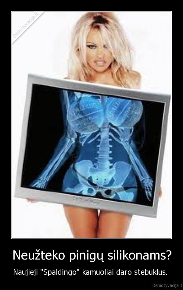 Neužteko pinigų silikonams?