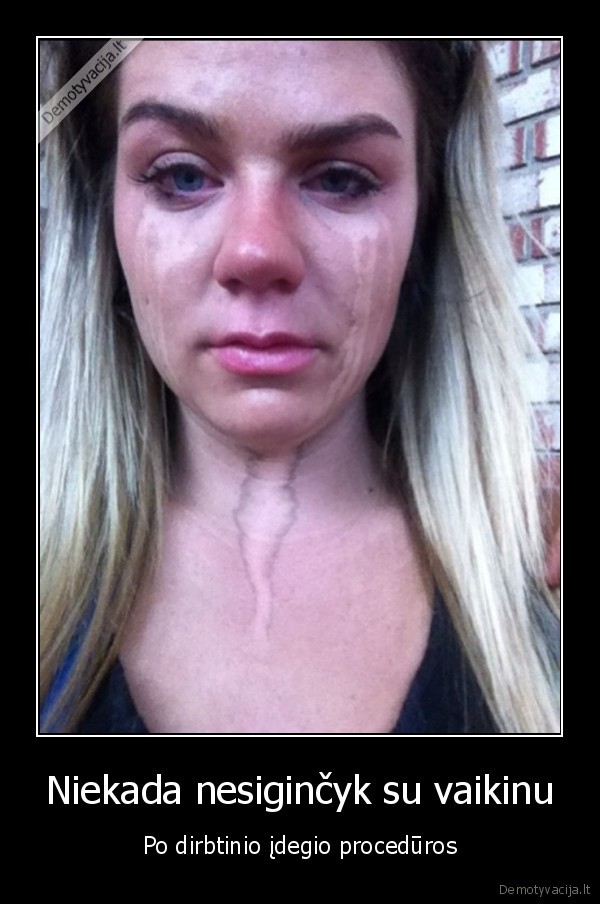 dirbtinis, idegis,poreles, gincas,gincas, iki, asaru