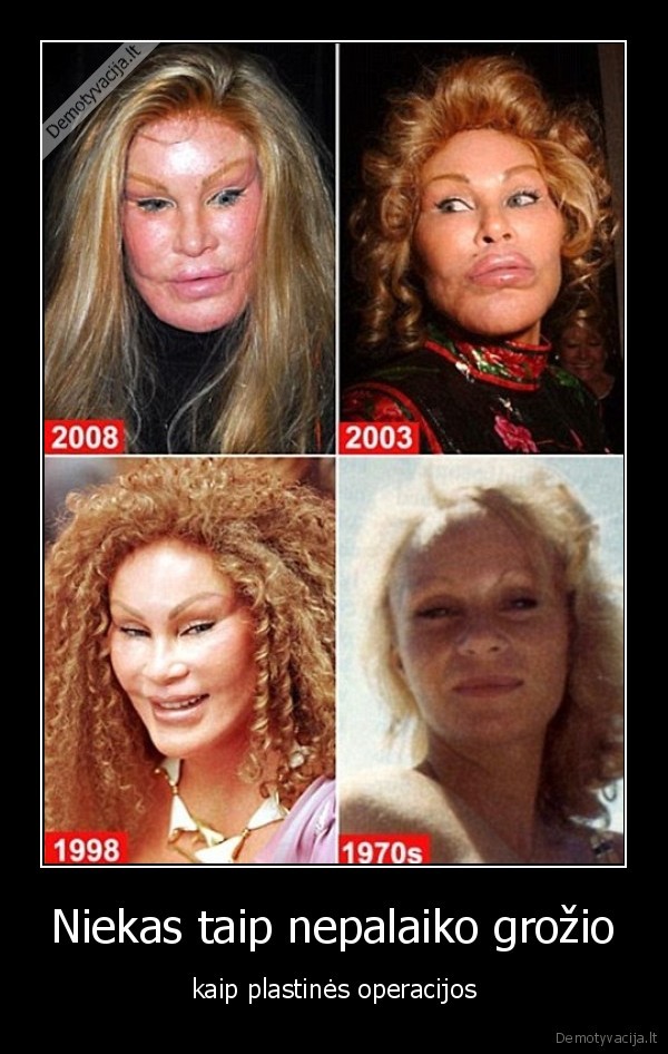 Niekas taip nepalaiko grožio