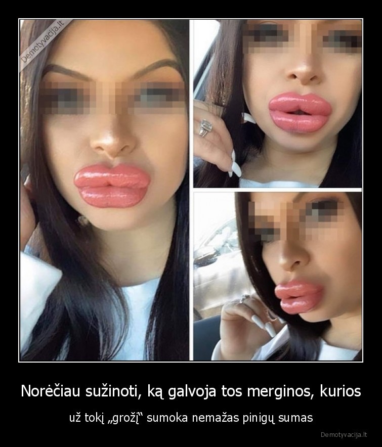 grozis,lupos,fyfa,botoksas,merginos
