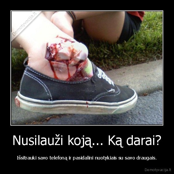 Nusilauži koją... Ką darai?