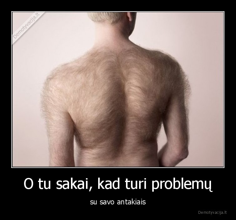 plaukai,problemos,nugara,antakiai