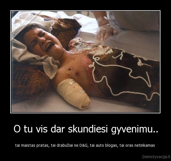 O tu vis dar skundiesi gyvenimu..