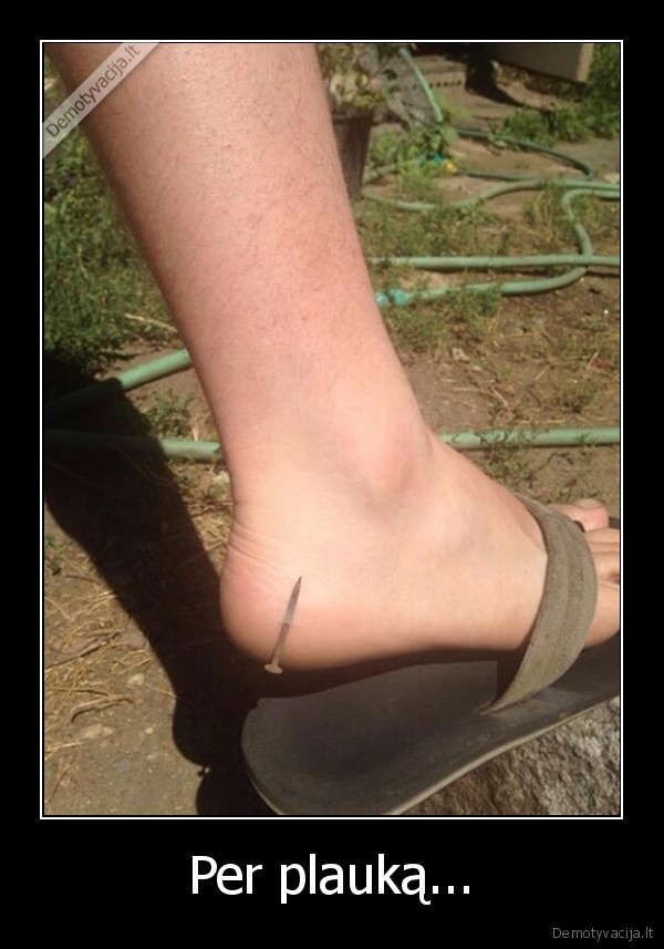 vinis, ismigo, i, koja,nelaimingas, atsitikimas