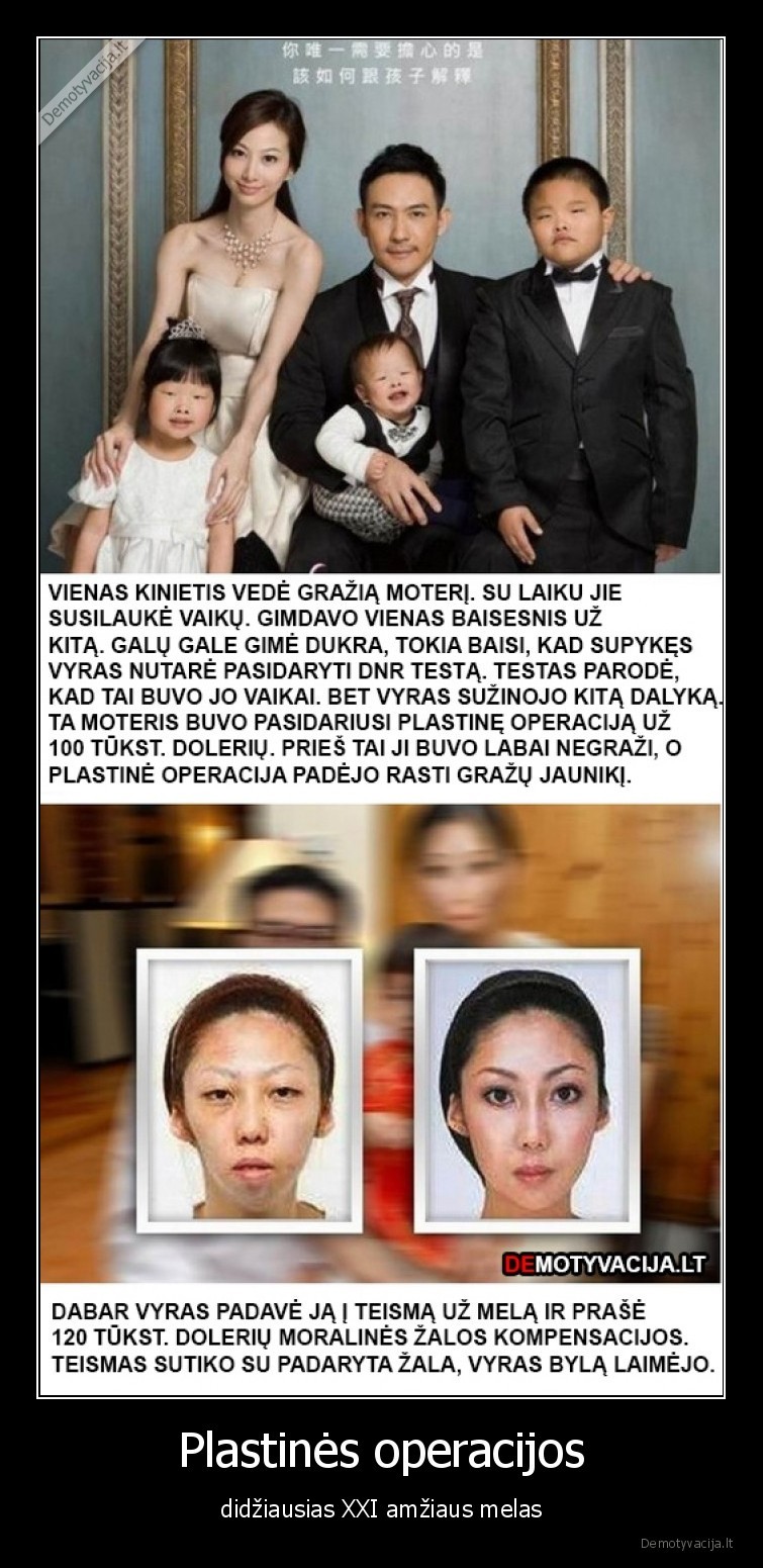 plastines,operacijos,meile,istorija